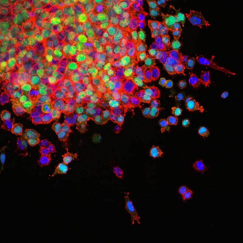 Extracellular matrix structure in cancer research