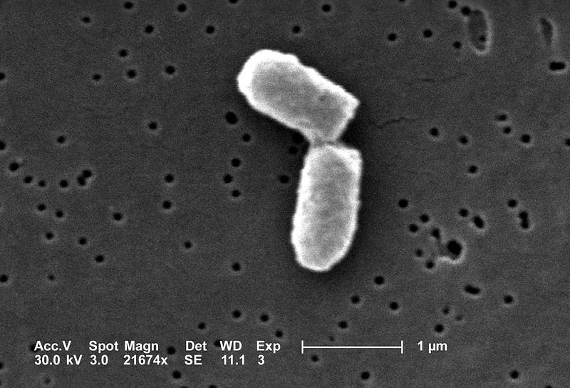 Scanning electron micrograph of dividing *E. coli* cells.